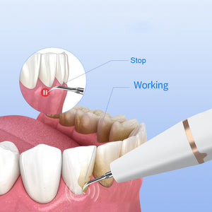 3-Speed Ultrasonic Electric Dental Cleaner with LED Light & Type-C Charging | Professional Plaque Remover Kit
