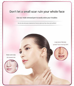 Skin Tag & Mole Remover Pen | White | 9-Level | USB Rechargeable | LED Display | Multi-Needle