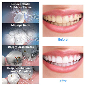 Advanced Water Flosser | Portable & Rechargeable | IPX7 Waterproof | 4 Modes | Black