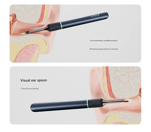 Smart Ear Cleaner | HD Camera & Tweezers | Visual Scope | Safe for Adults & Kids | White