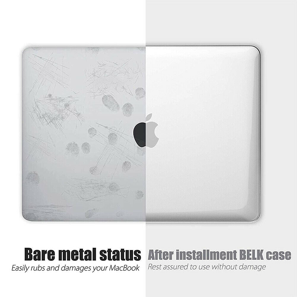 2020 MacBook Pro 13 Inch Case | Plastic Hard Case Shell for MacBook Pro A2251 A2289 A2179 (Clear)