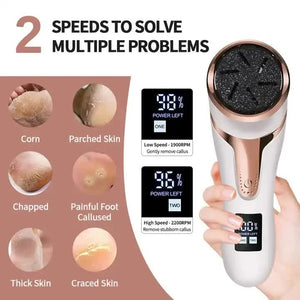 Black Electric Foot Callus Remover | Rechargeable Waterproof Pedicure Tool | Automatic Dead Skin Removal