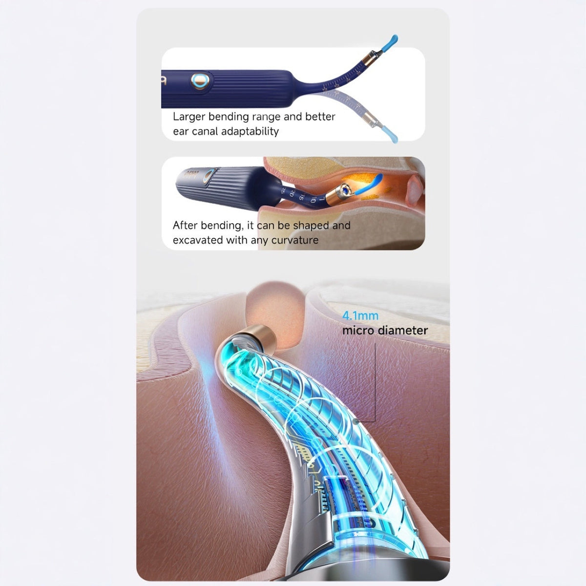 Smart Ear Cleaner | HD Camera | Precision Tweezers | Safe for Kids & Adults | Blue