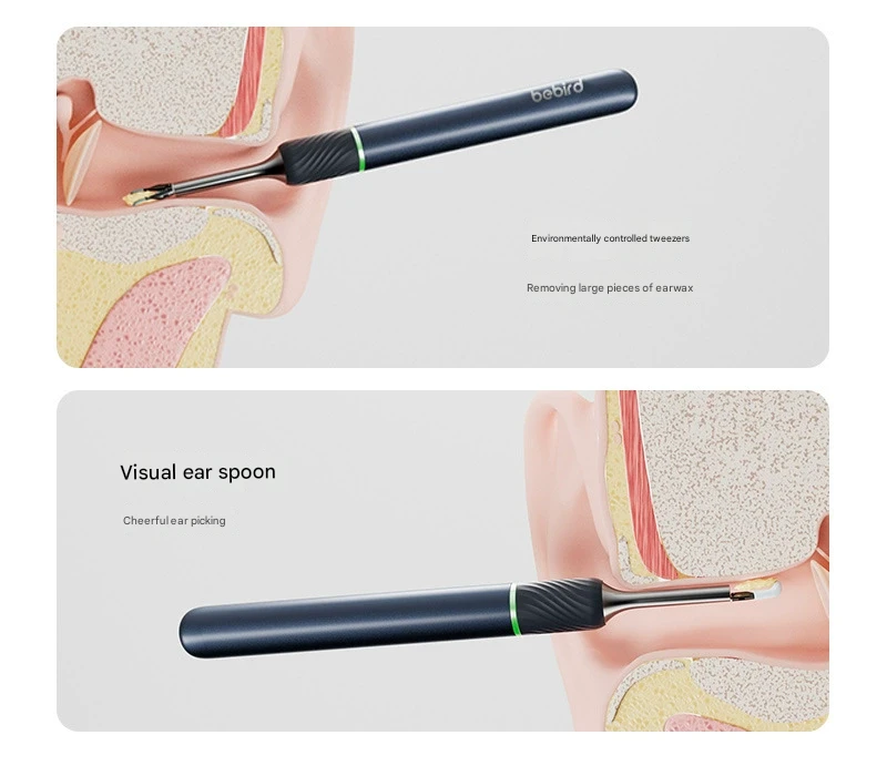 Smart Ear Cleaner | HD Camera & Tweezers | Visual Scope | Safe for Adults & Kids | White