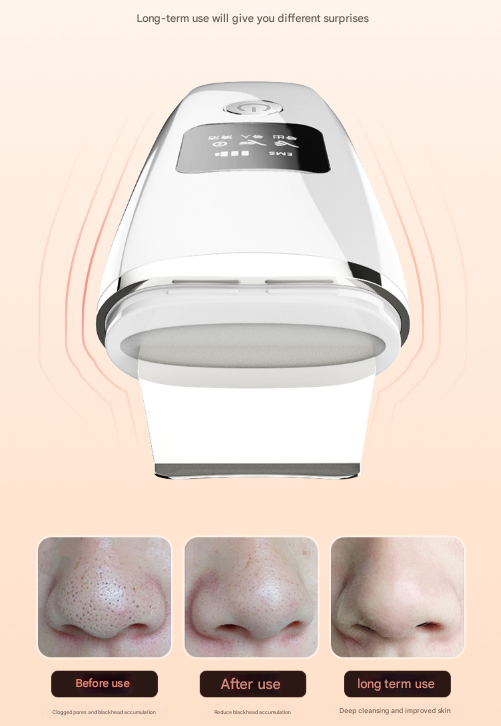 Ultrasonic Skin Scrubber 4-in-1 | Professional Deep Pore Cleanser | Blackhead Remover & EMS Lifting Tool | White