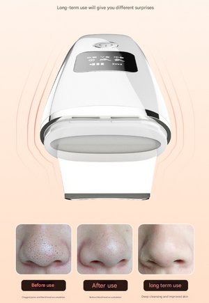Ultrasonic Skin Scrubber 4-in-1 | Professional Deep Pore Cleanser | Blackhead Remover & EMS Lifting Tool | White