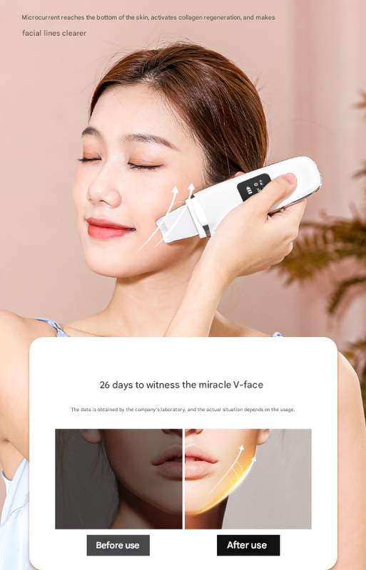 Ultrasonic Skin Scrubber 4-in-1 | Professional Deep Pore Cleanser | Blackhead Remover & EMS Lifting Tool | White