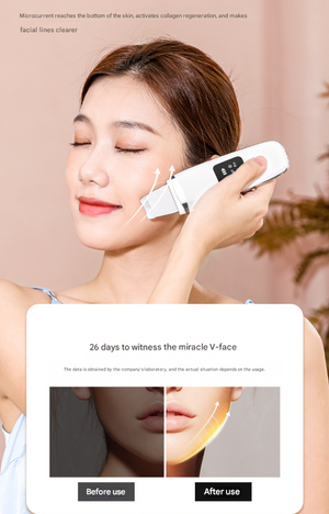 Ultrasonic Skin Scrubber 4-in-1 | Professional Deep Pore Cleanser | Blackhead Remover & EMS Lifting Tool | White