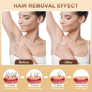 IPL Hair Removal Device | 3-in-1 Permanent Hair Reduction, Skin Rejuvenation & Acne Control | White