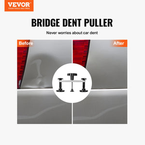 Dent Removal Kit 25 Piece | Paintless Auto Body Repair Tools with Glue Gun & Puller Tabs