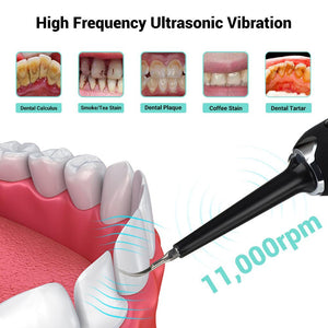 High Frequency Electric Ultrasonic Dental Tartar Plaque Calculus Tooth Remover Kit (Light Green)